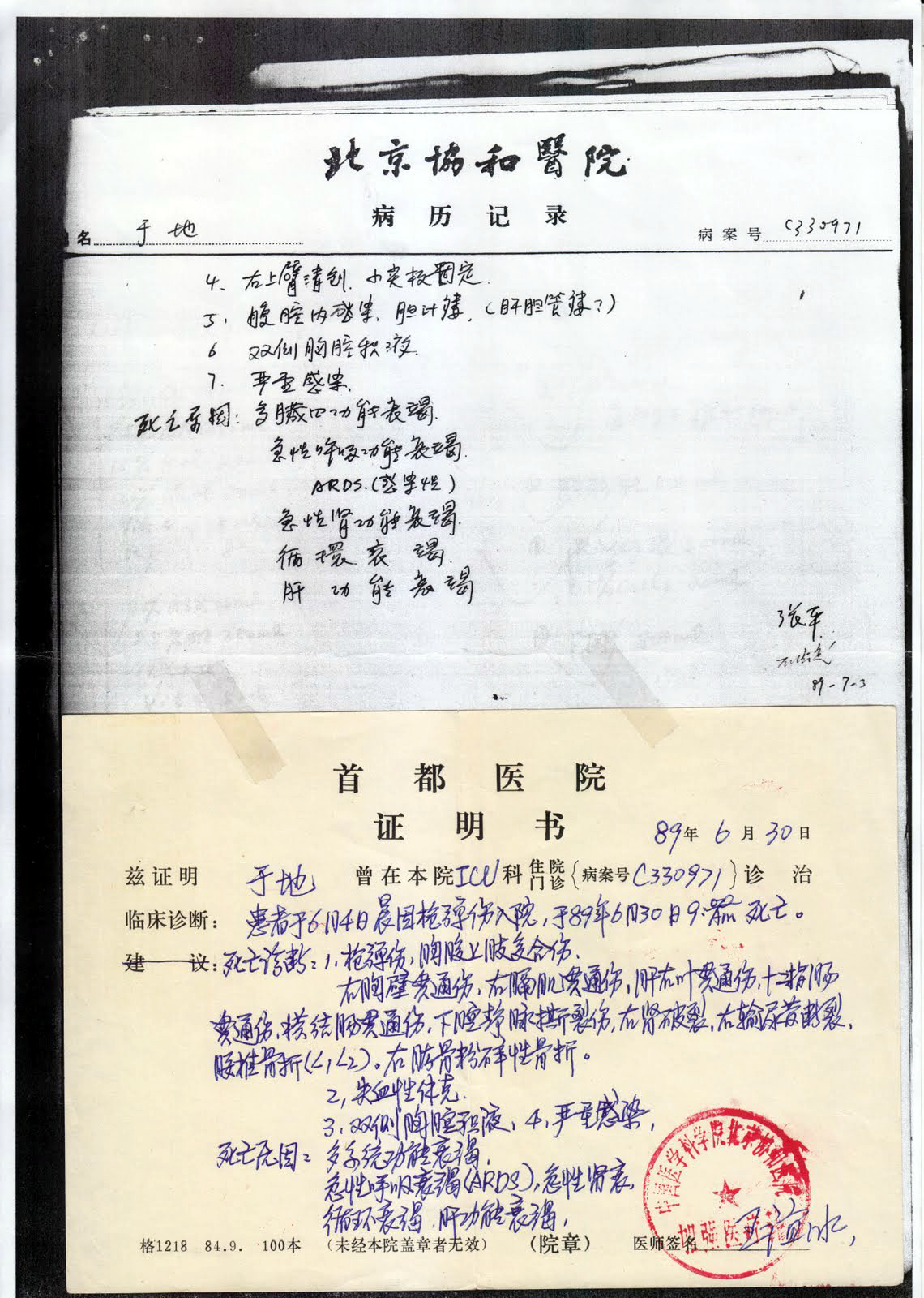 YPhotocopy of (top) part of Yü’s medical records at the Beijing Xiehe Hospital and (bottom) death certificate issued by the Capital Hospital stating the cause of death as multiple organ failure, including of the kidney and liver, and acute respiratory distress syndrome (ARDS).